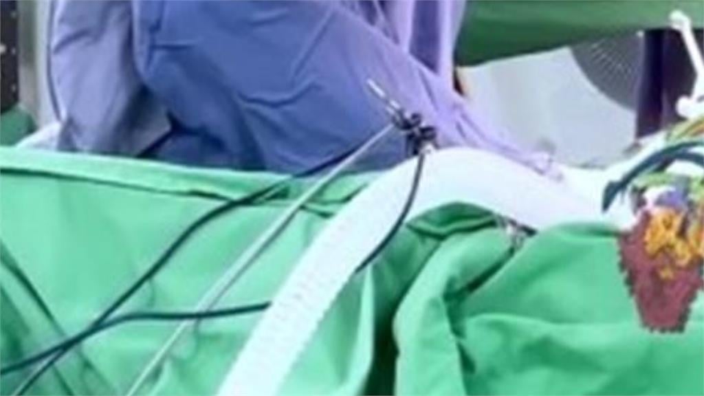 遭爆「無照醫療廠商執刀」醫生一旁納涼!中榮「態度大轉彎改口」發聲回應了