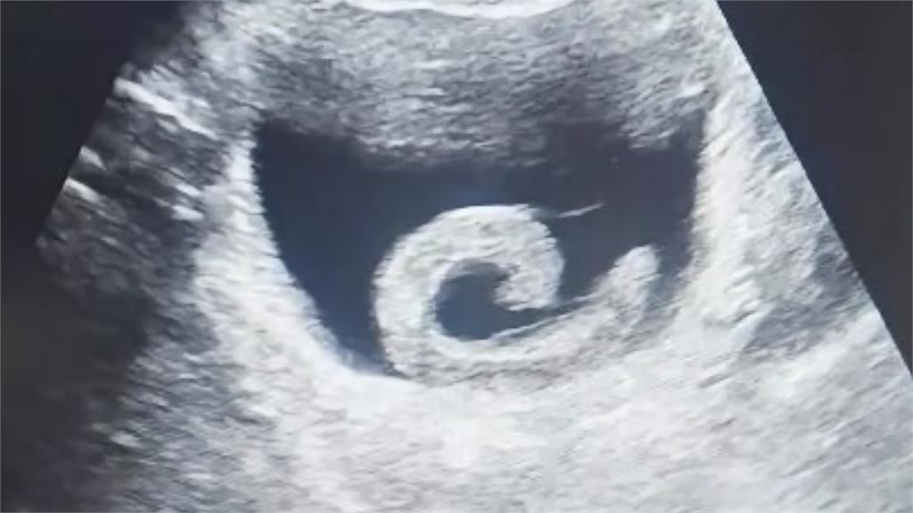 為追求「奇特效果」竟將活體生物塞尿道!他下秒「劇痛、尿不出來」急衝醫院