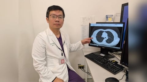 肺癌初期「幾乎無症狀」!LDCT早期發現!醫:「這事」肺癌風險評估最重要