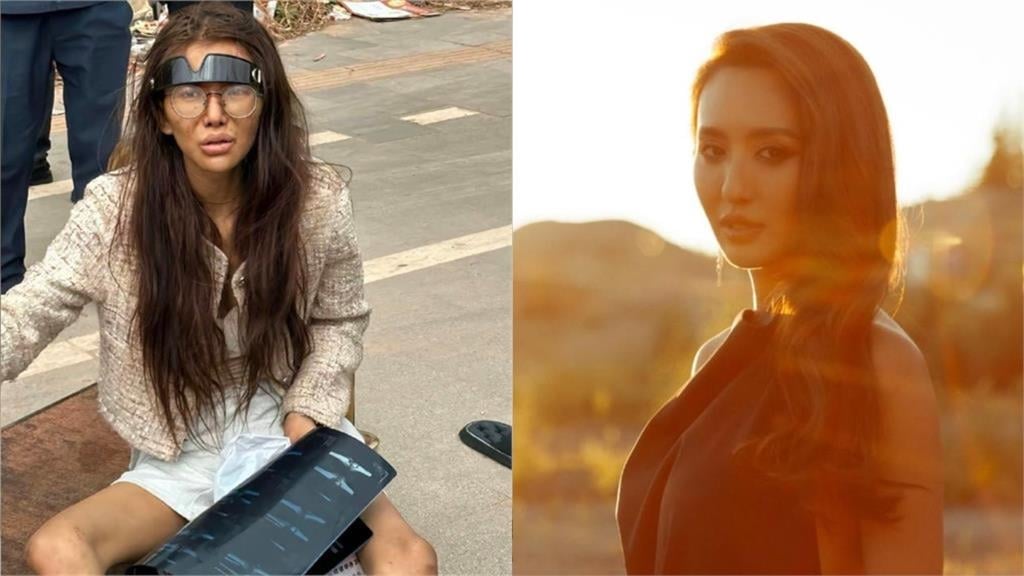 薔薔遭錯認成「柬埔寨斷腿網紅」!本尊傻眼曬「素顏照」喊:我沒有法令紋