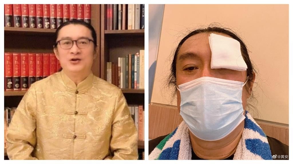 黃安「換上僧袍、頭頂全淨空」出家了？自爆「飛中國商演」出事：一張口全沒了