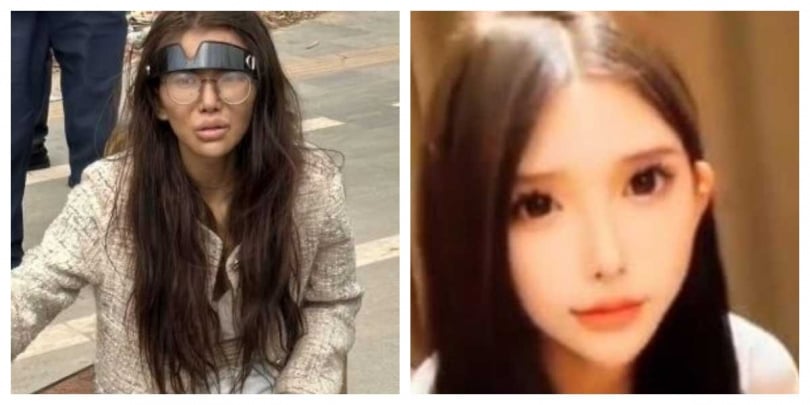 大陸一名20歲網紅Umi日前驚傳被男友騙至柬埔寨後重傷流浪街頭,引發廣泛關注。(圖/翻攝自微博)