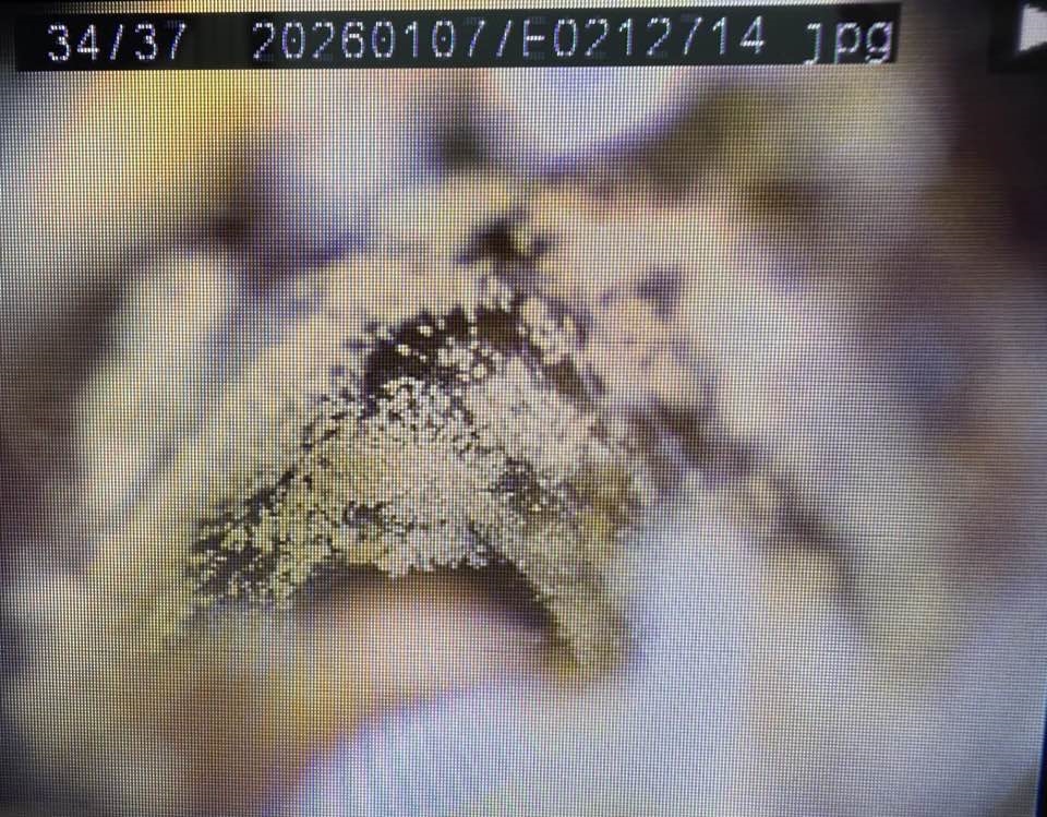 密集恐懼滲入!年輕女耳朵竟「長白香菇」畫面曝光 醫揭「1習慣」惹禍:長黴了