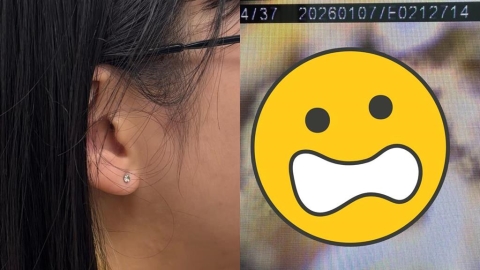 密集恐懼慎入!年輕女耳朵竟「長白香菇」畫面曝光 醫揭「1習慣」惹禍:長黴了