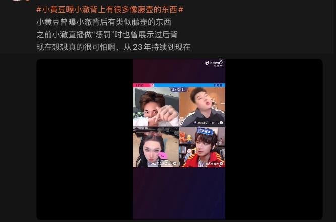 男兒身網紅「抗HIV藥物」直播露出！昔爆「背部長滿凸起顆粒」脫衣片被挖