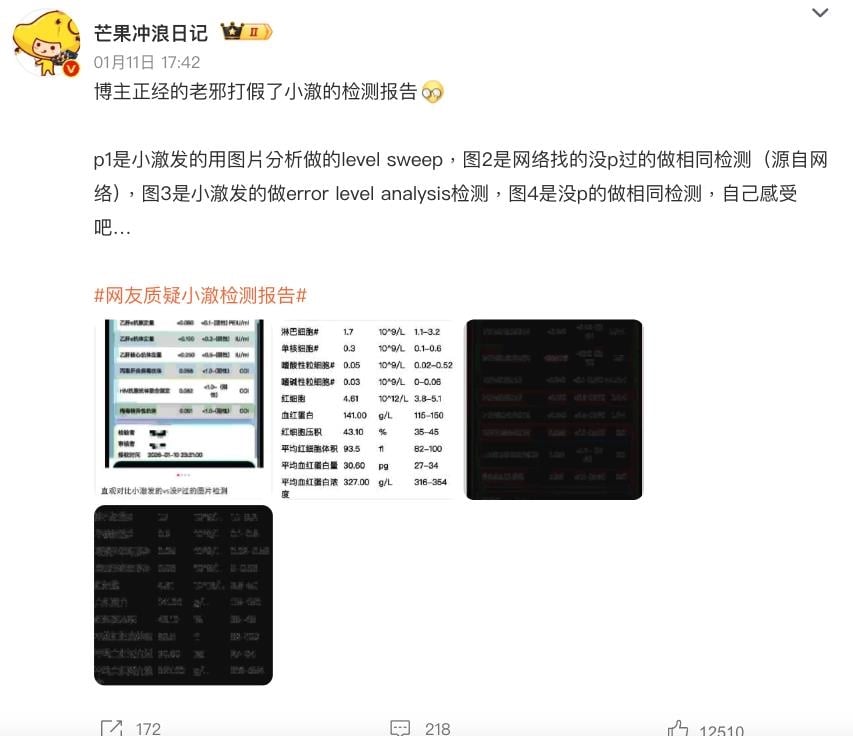 男兒身網紅「抗HIV藥物」直播露出！昔爆「背部長滿凸起顆粒」脫衣片被挖