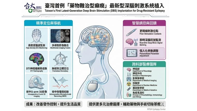 跨科部整合突破困境！完成「藥物難治型癲癇」深腦刺激系統植入