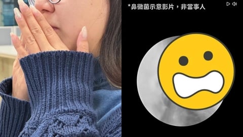 他口臭到老婆想離婚「刷牙也沒用」!醫一看元凶竟是「鼻子長滿黴菌球」畫面曝光