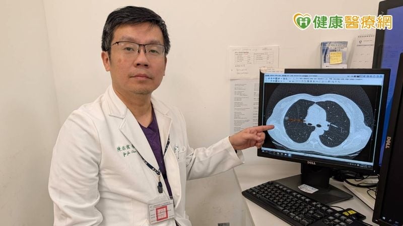 母罹癌女兒警覺！LDCT篩檢竟也揪出早期「肺癌」