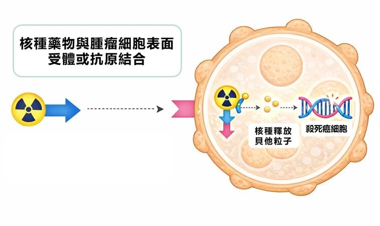 放射精準標靶治療讓診斷與治療合一　攝護腺癌控制邁入新里程碑