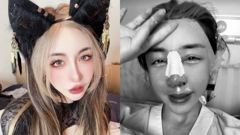 雪碧「12年假鼻」不要了！才爆「整形失敗」飛上海求醫⋯虛弱插管照流出