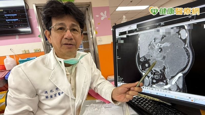 主廚肚子痛到無法呼吸？竟是「胰臟炎」併發症喪命