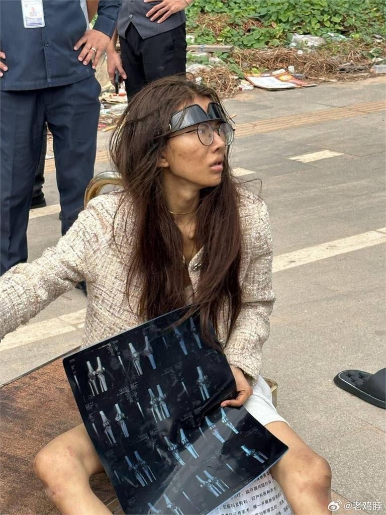 20歲「斷腿女網紅」流浪柬埔寨！回中國藥檢被驗「2毒陽性」家屬全說了