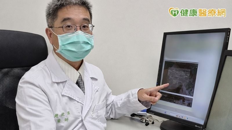 初次騎飛輪強度高　25歲女「急性橫紋肌溶解症」