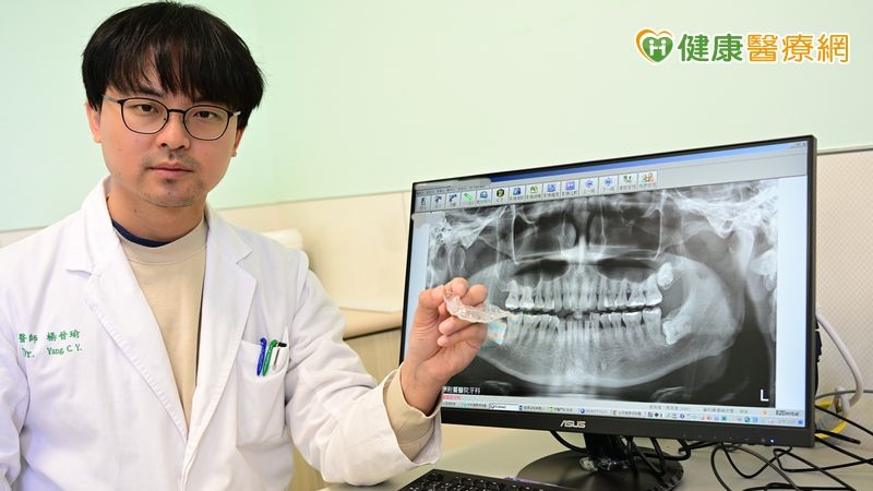 闆娘牙齦萎縮、牙縫變大竟是每晚磨牙惹禍！醫籲高壓力族群要當心