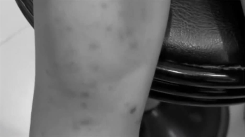 高雄小學驚傳「腸病毒群聚」15童染疫！「醫護夫妻」隱瞞兒女病情挨罰12萬