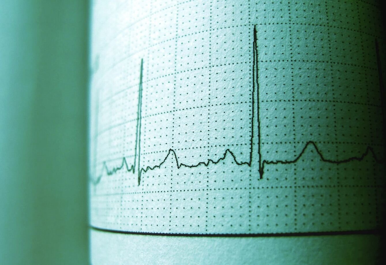 健壯導遊爬山「喘又心跳亂」 咖啡喝太多？其實已心房顫動 16