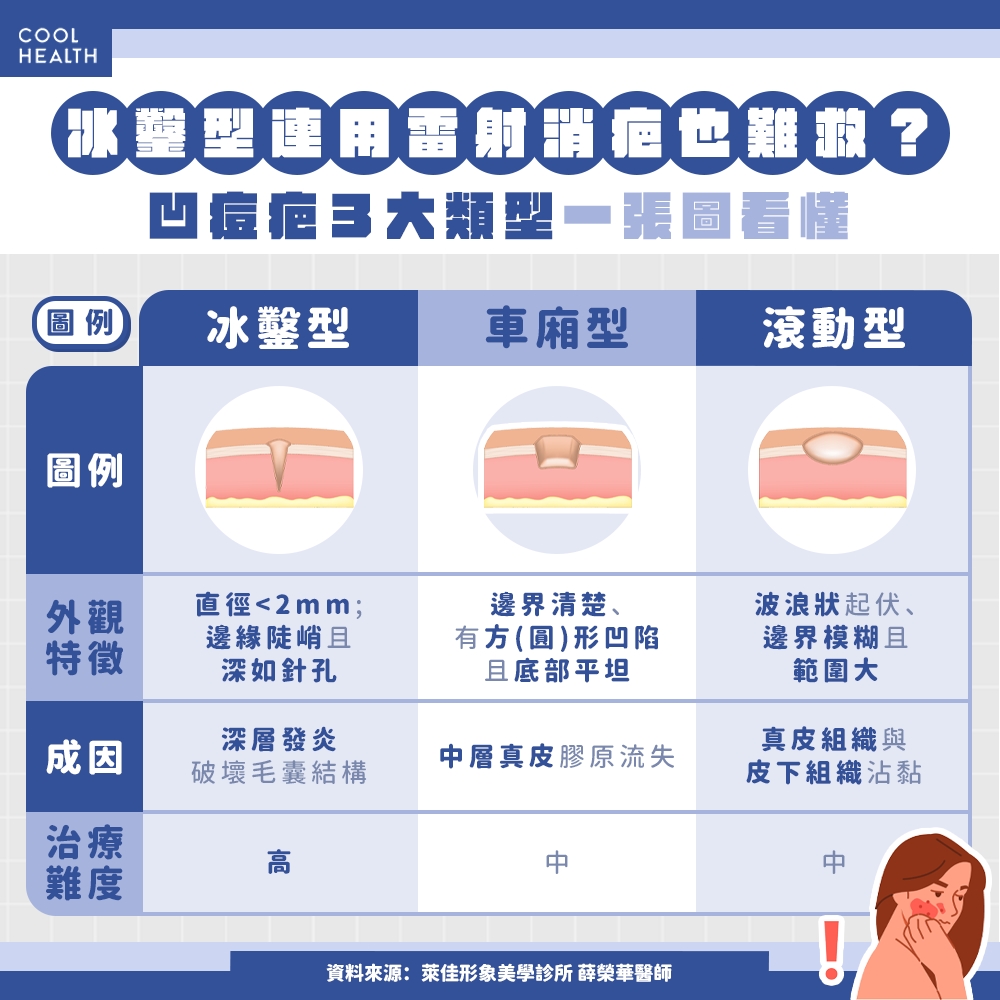 年前變美大作戰！ 新的一年直球對決「凹痘型痘疤」，醫曝1技術兼顧消疤痕、改善膚質