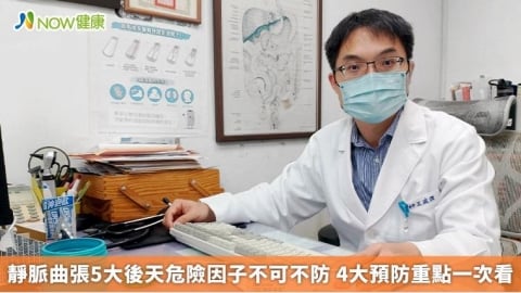 靜脈曲張5大後天危險因子不可不防 4大預防重點一次看