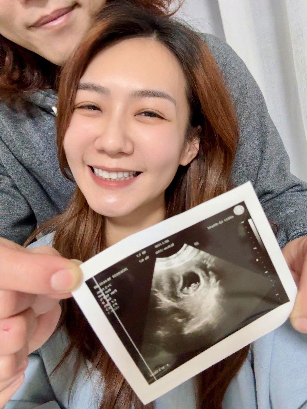 李又汝「宣布懷孕」曬超音波照！曾被診斷難受孕 曝過程有如奇蹟「不敢相信」