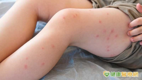 女童疑遭「蘋果病」B19病毒奪命　疾管署：若併發心肌炎致死率達3成