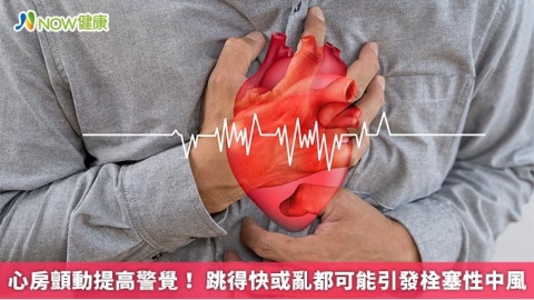 心房顫動提高警覺！ 跳得快或亂都可能引發栓塞性中風