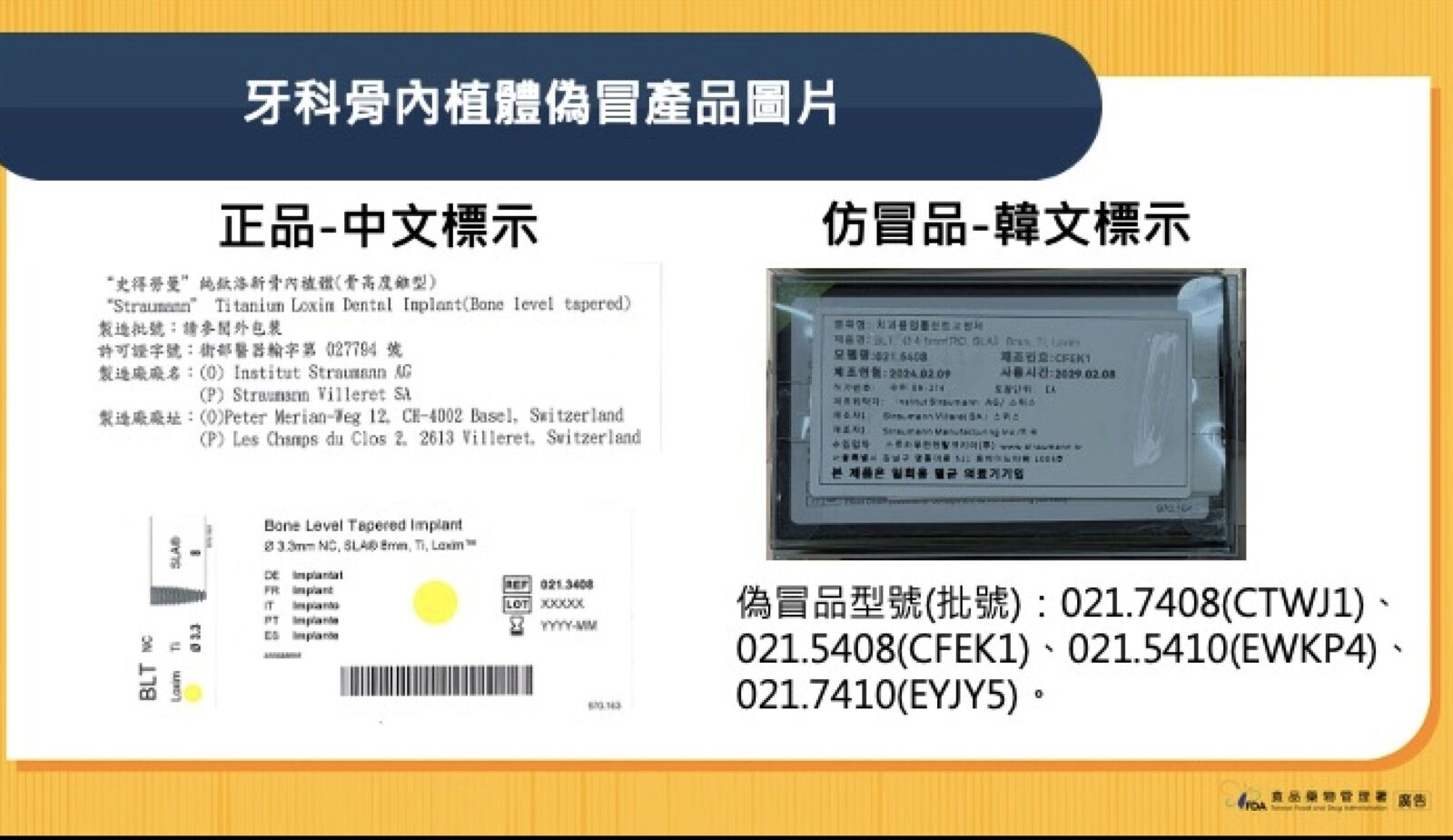 高價植牙有「假」！食藥署查獲仿冒骨內植體 韓文標示4批號曝光 3