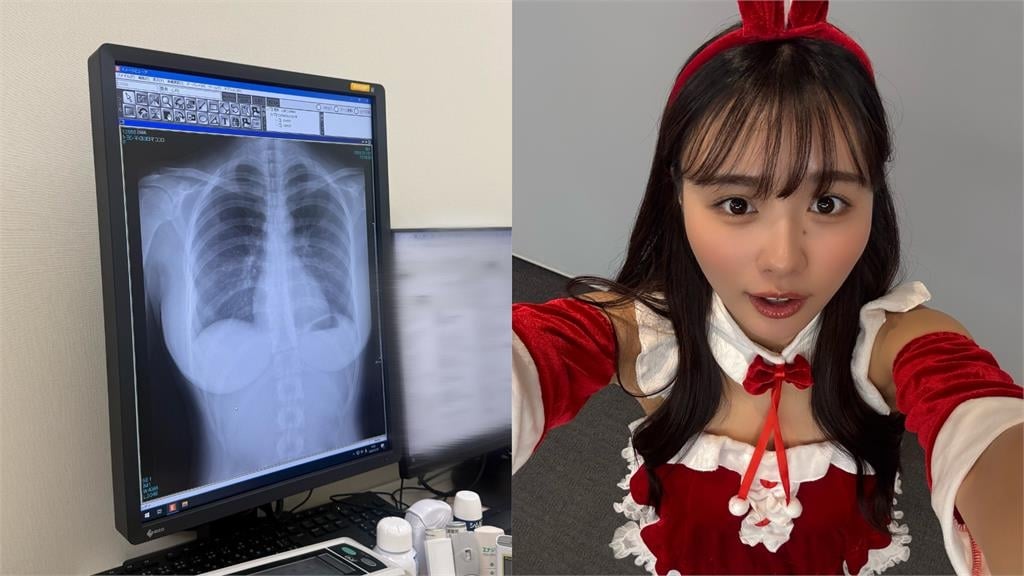 暗黑女偶像曬X光照「肺部很乾淨」狂吸4千萬人朝聖！畫面曝光…網歪樓1亮點：純天然
