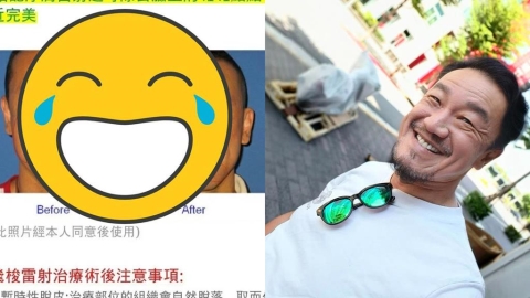 醫美模特「對比照外流」竟是陳為民！「打碼無效」秒被認出網笑：2張都before？