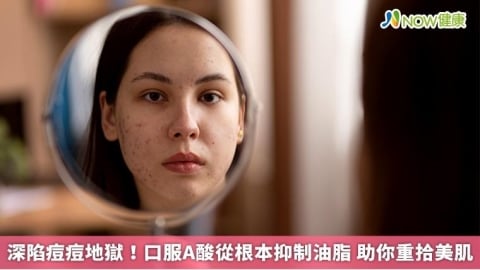 深陷痘痘地獄！口服A酸從根本抑制油脂 助你重拾美肌