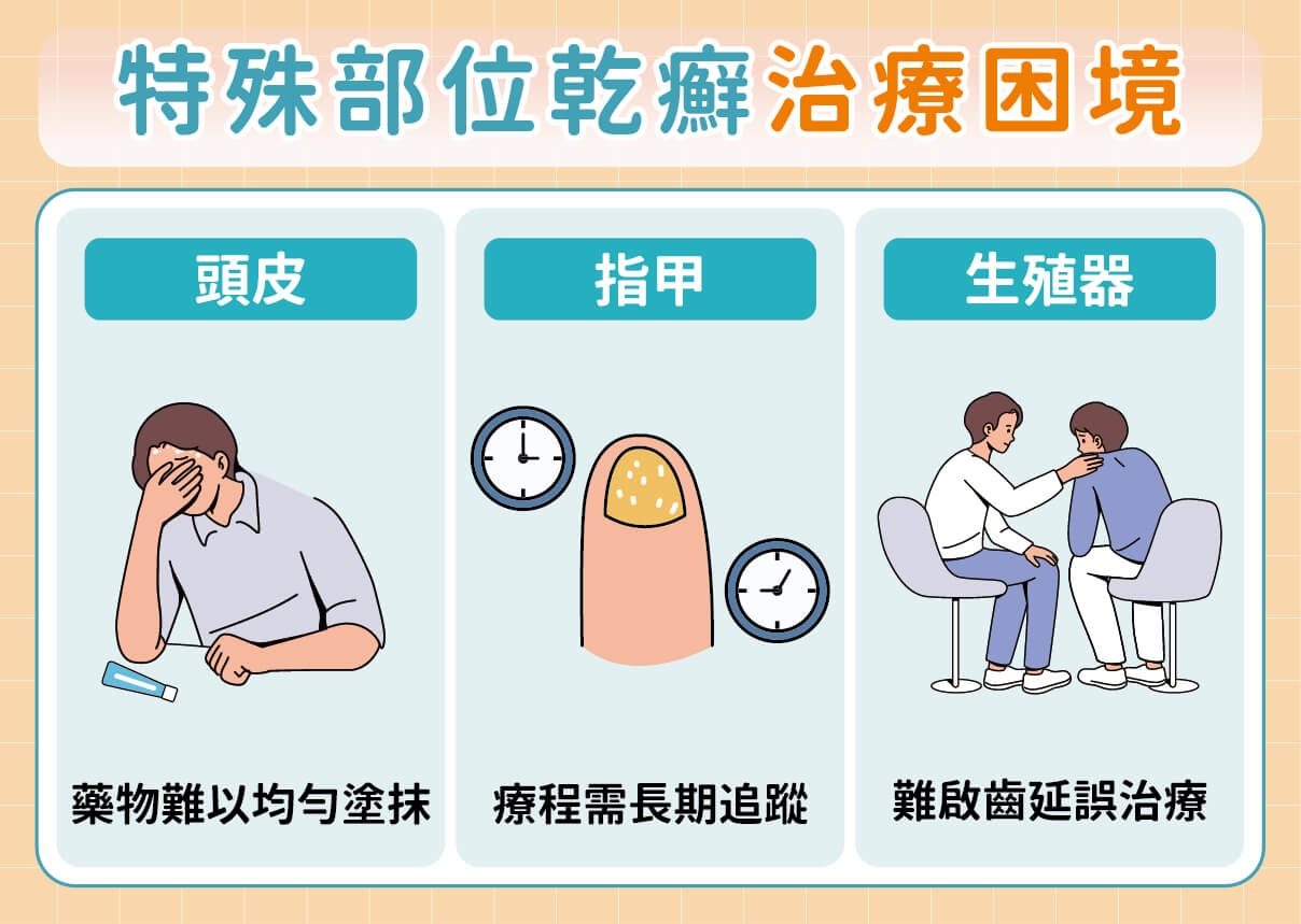 乾癬長在手腳、生殖部位好尷尬？醫揭治療新突破與3招溝通訣竅