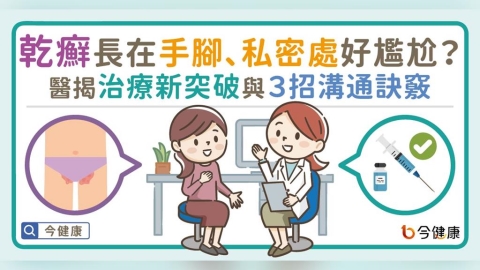 乾癬長在手腳、生殖部位好尷尬?醫揭治療新突破與3招溝通訣竅