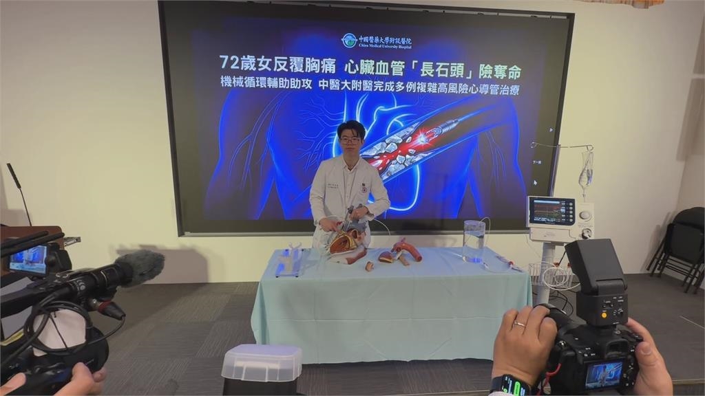 72歲女子心臟血管「長石頭」 胸痛、冒冷汗一週險奪命