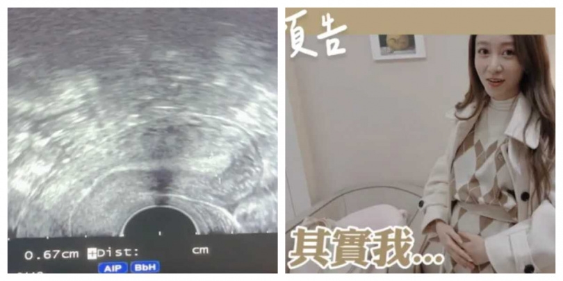 篠崎泫凍卵時期挺著大肚子。（圖／翻攝自YT，篠崎泫Hsyan Hsiaochi）