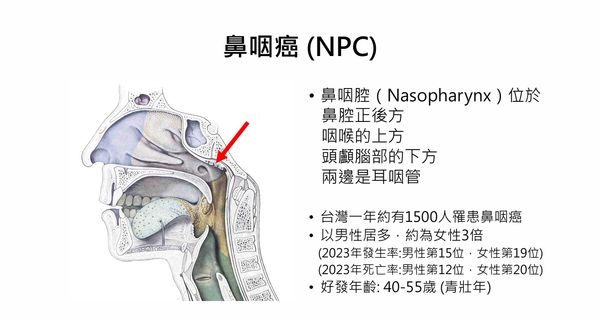 知名韓星、羽球國手都是患者！臺大醫研究：每周一杯綠茶　鼻咽癌風險降