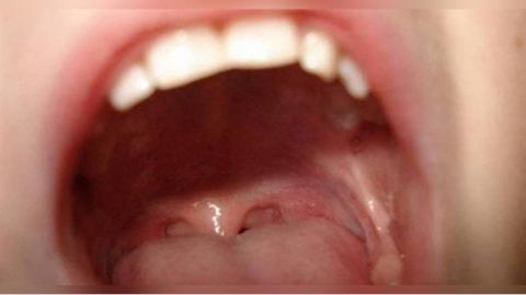 女主管張嘴飄「煮熟高麗菜味」!每天刷3次牙還是臭 專家揭元凶