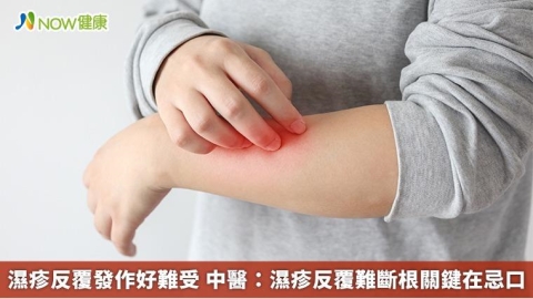 濕疹反覆發作好難受 中醫：濕疹反覆難斷根關鍵在忌口