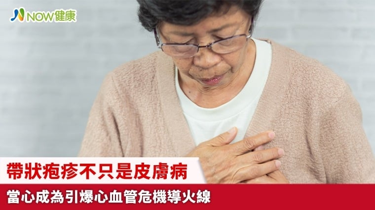 帶狀疱疹不只是皮膚病 當心成為引爆心血管危機導火線