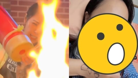 勇兔突「緊急動刀」病況震撼粉絲!私下「素顏躺病床」畫面流出