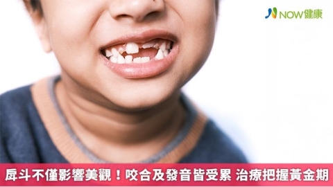 戽斗不僅影響美觀！咬合及發音皆受累 治療把握黃金期