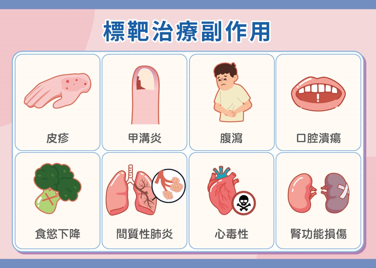 晚期肺癌標靶藥物治療前 先認識「這些副作用」