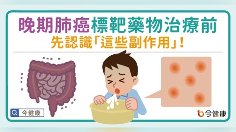 晚期肺癌標靶藥物治療前 先認識「這些副作用」