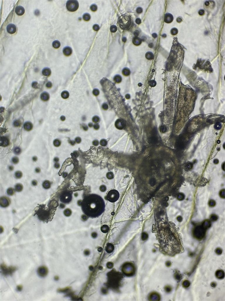 爛痘一年治不好！正妹臉上竟藏「百隻八腳蟲」狂繁殖...醫：妳餵飽牠們