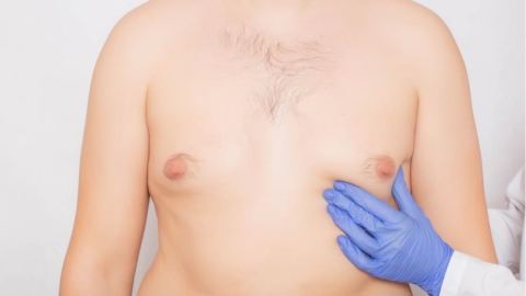 猛健樂瘦身仍甩不掉「肥仔波」？醫揭男性女乳症頑固真相