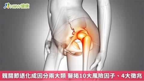 髖關節退化成因分兩大類 醫揭10大風險因子、4大徵兆