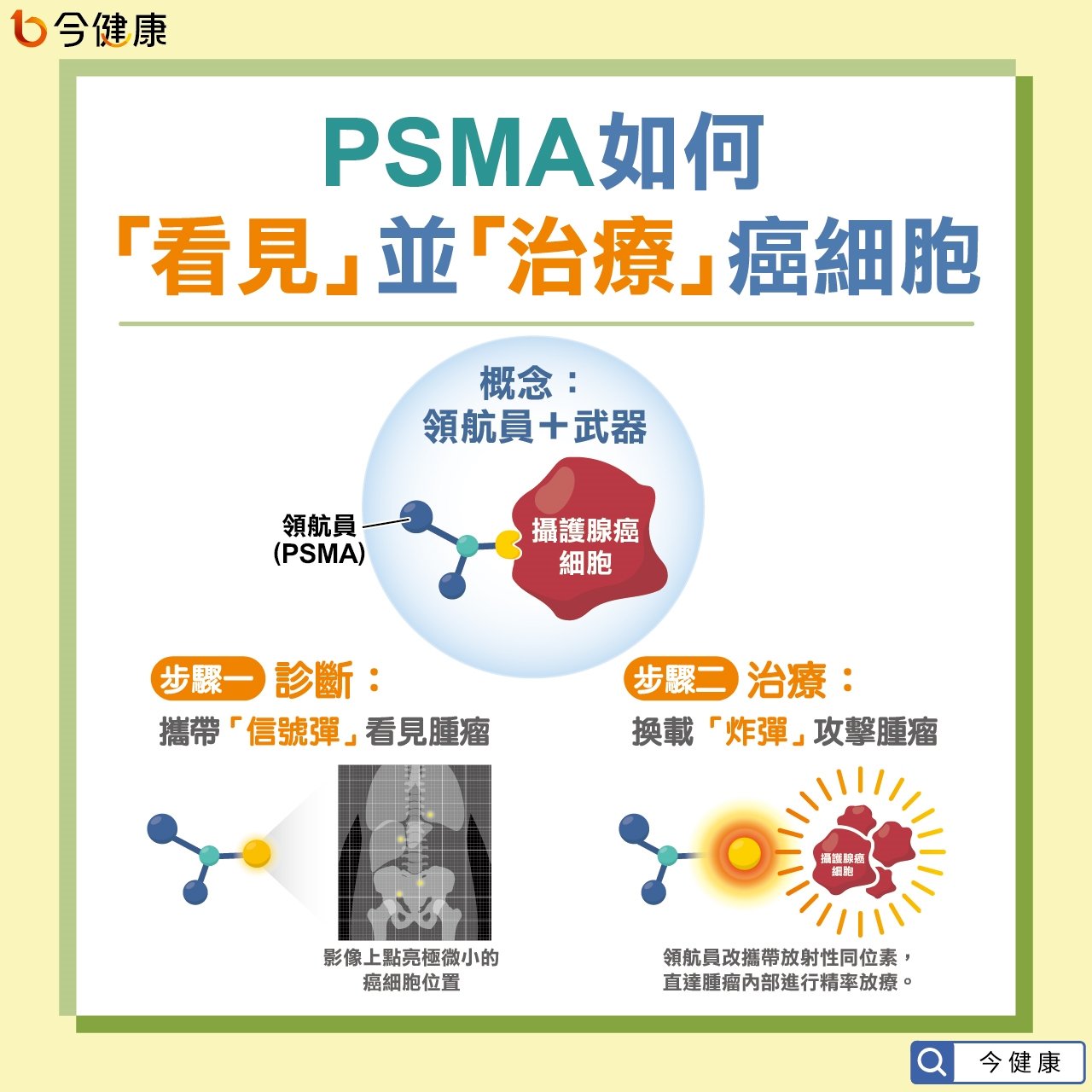 #台大 #臺大 #路景竹 #攝護腺癌 #放射性標靶治療 #PSMA 