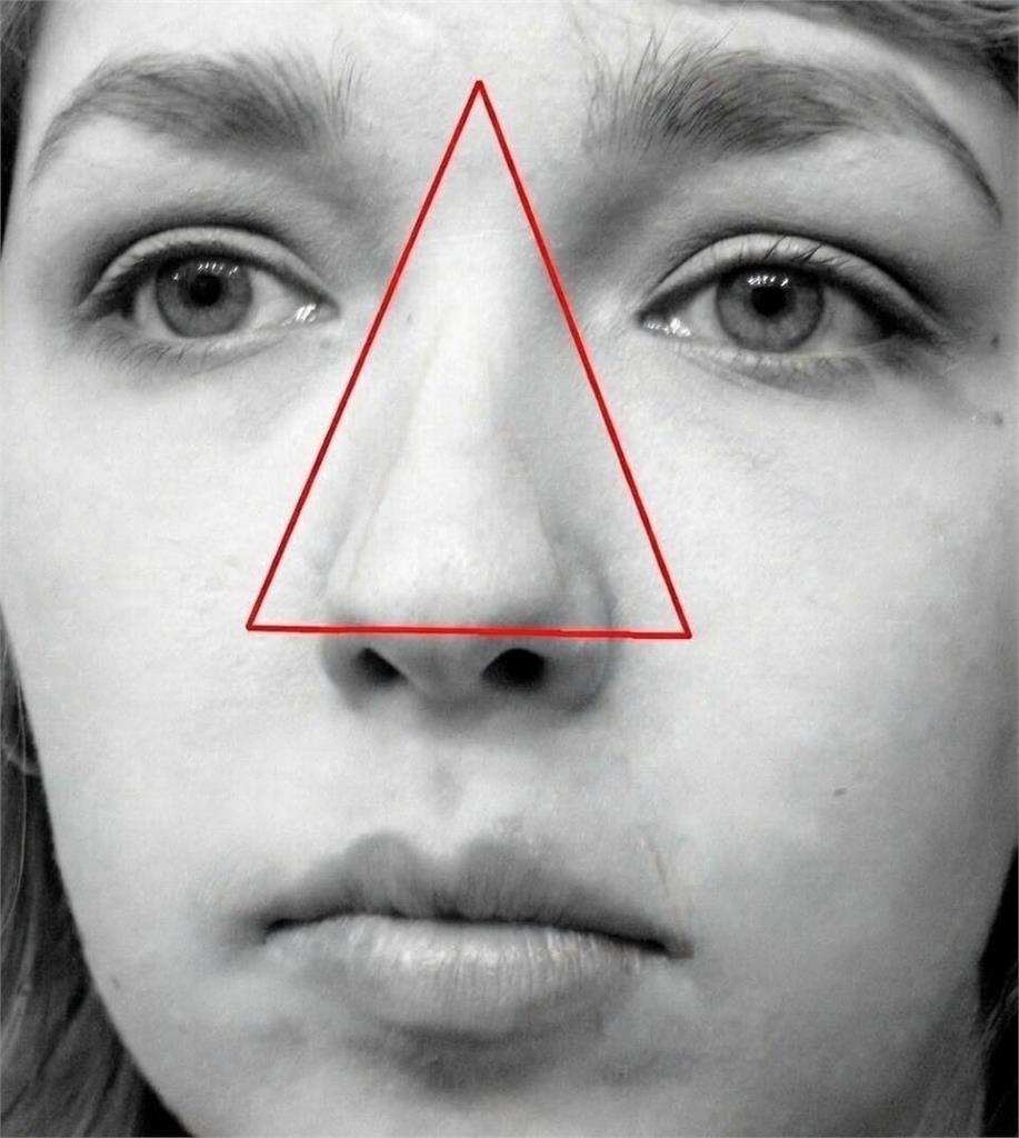  臉上痘痘別亂擠！醫示警「危險三角區」千萬別碰：一不小心就喪命