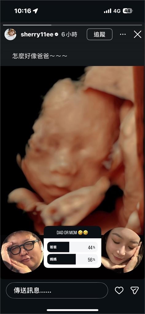 納豆寶貝女兒長相首曝光！依依PO「超真實對比照」笑了：怎麼好像爸爸…