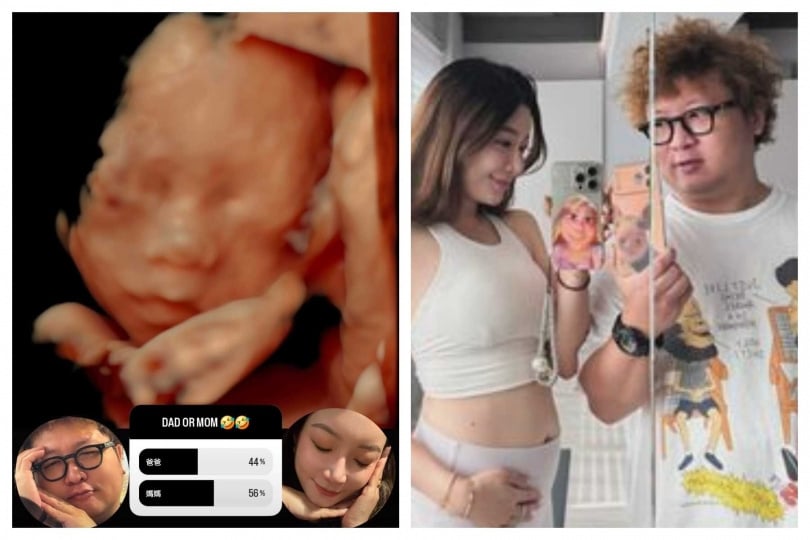 依依在IG開放票選，網友多認為女兒像媽媽，但她笑說像爸爸。（圖／翻攝自IG，sherry11ee）