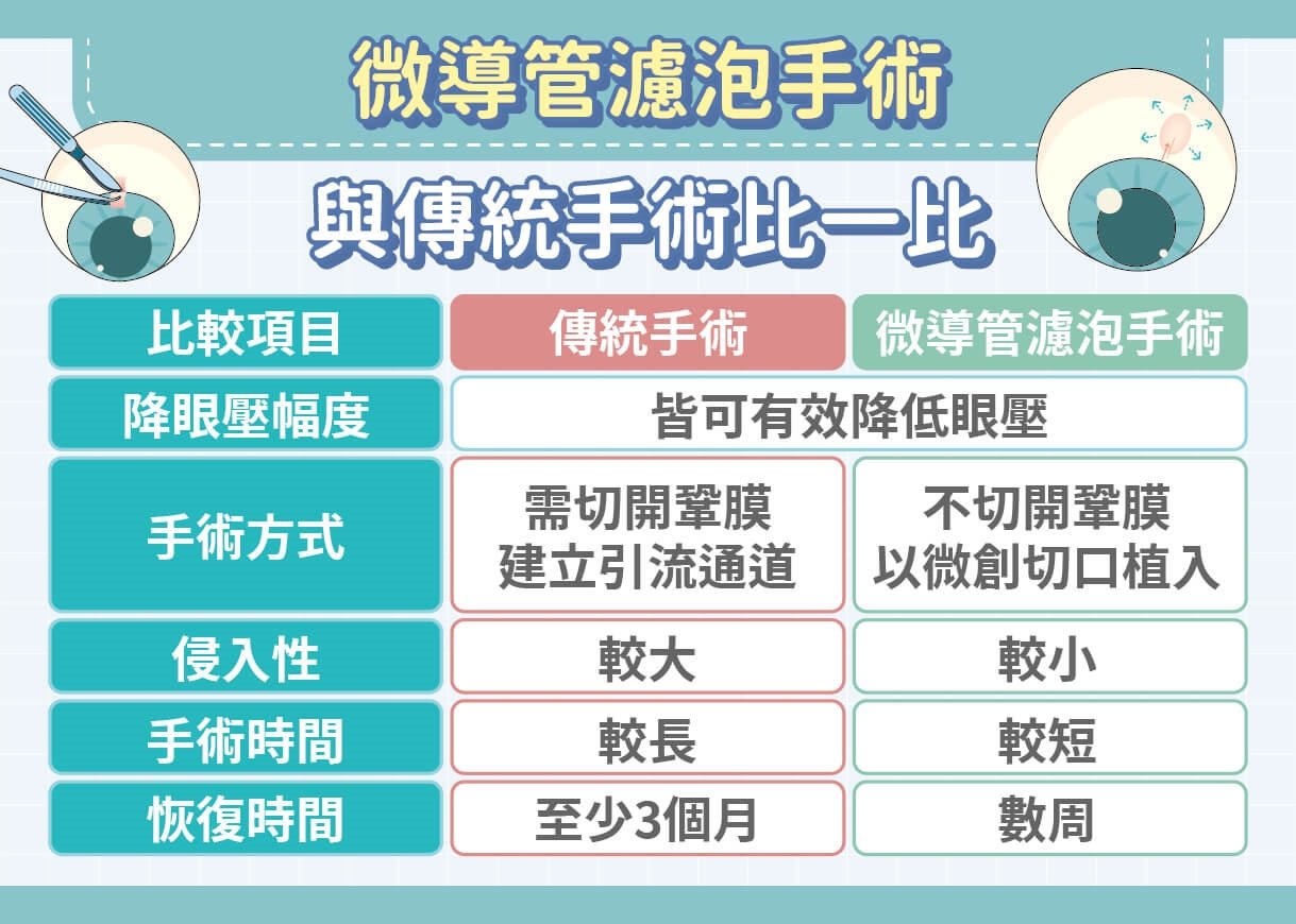 青光眼治療新趨勢：微創手術免住院、恢復快！數週快速回歸精彩生活